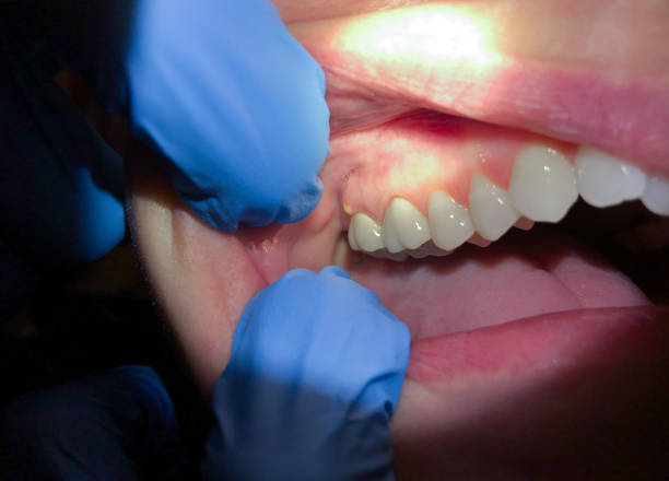 Best Emergency Dental Services for Seniors in Fair Lakes, VA
